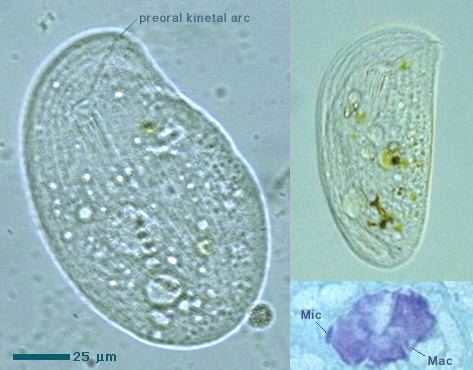 Chilodonella!